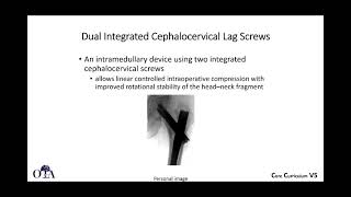 Intertrochanteric femur fractures  3 of 3 [upl. by Lenra744]