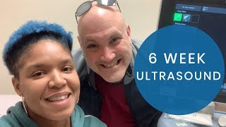 6 WEEK APPOINTMENT  RAINBOW PREGNANCY UPDATE [upl. by Fraya]