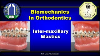 Intermaxillary Elastics in Orthodontics [upl. by Namrehs]