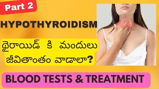 Hypothyroidism Low thyroidTests amp Treatment  How to Take Thyroid Medicine Dr SasapuTelugu [upl. by Cai205]