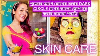 পুজোর আগে চোখের তলার Dark Circle মুখের কালো ছোপ দূর করার ঘরোয়া পদ্ধতি homecare beautyexpert [upl. by Acinorev]