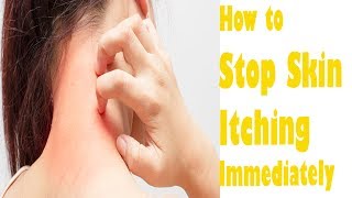 How to Stop Skin Itching Immediately  A Megical Homemade Anti itching Cream 100 Working [upl. by Virge]