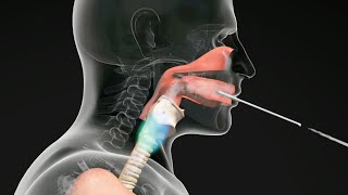 How do Straw Exercises Help the Voice Get Better voicetherapy [upl. by Ariane]