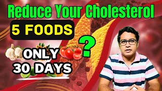 TOP 5 FOODS That Will Change Your Cholesterol  Prevent Heart Attack [upl. by Zetra]