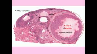 Ovarian Cysts  CRASH Medical Review Series [upl. by Ahsas]