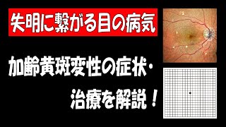 失明に繋がる病気、加齢黄斑変性の症状・治療を解説！ [upl. by Rexferd]