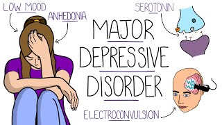 Depression Explained Major Depressive Disorder [upl. by Ayin853]