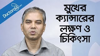 মুখের ক্যান্সারের চিকিৎসা Mouth cancer symptoms amp treatment in banglabangla health tips [upl. by Marjy45]