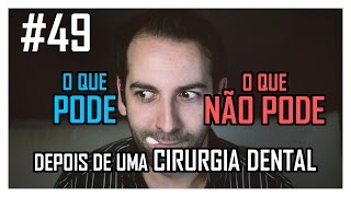 49 O que PODE e NÃO PODE depois de uma cirurgia dental [upl. by Senilec]