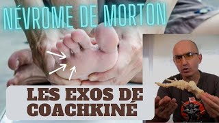 Névrome de MORTON mal au pied les solutions naturelles morton halluxvalgus podologie orteils [upl. by Tekcirc]