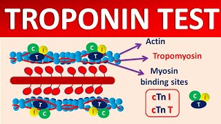 Troponin test and its significance [upl. by Alrick]