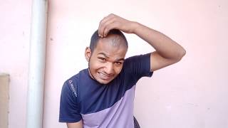 Minoxidil Review After Use 9 Month। Sonu Kumar Mishra। [upl. by Fiorenze566]