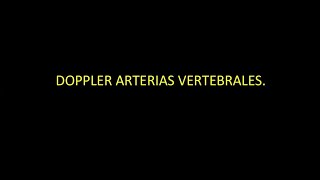 19 Doppler de arterias vertebrales  Dr González [upl. by Dnama]