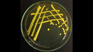 Micrococcus luteus  the most common cleanroom bacterium [upl. by Mellins291]