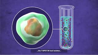 Screening Tests For Tuberculosis [upl. by Aninotna]