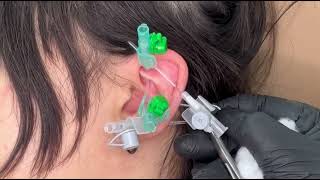 Industrial piercing  Rook piercing  Conch piercing  Inner lobe piercing [upl. by Enrobyalc607]