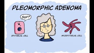 Pleomorphic Adenoma [upl. by Aernda908]