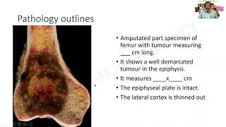 Osteoclastoma  GAME 20  Dr G Shivashekar  SRM  Pathology MBBS practical  University Questions [upl. by Yde]