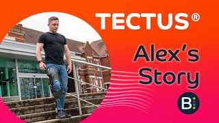 Tectus® Case Study Alex ExMilitary Feature [upl. by Xenophon]