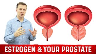 How To Fix Enlarged Prostate Explained By Dr Berg [upl. by Norbie]