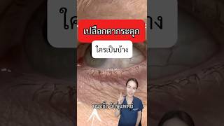 ตากระตุก หมอกิ๊ก จักษุแพทย์ ophthalmologist เปลือกตากระตุก ตากระตุก eyelidtwitch myokymia [upl. by Ridinger]