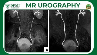 Magnetic Resonance Urography MRU MR Techniques amp Clinical Applications MIR Test amp Safety [upl. by Wesa]