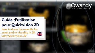 3 How to draw the mandibular canal and to visualise in 3D view Quickvision 3D [upl. by Halbeib]