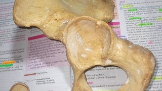 Acetabulum and Obturator foramen Human Anatomy [upl. by Wolfgang]