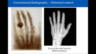 Introduction to Radiology Conventional Radiography [upl. by Goldarina288]