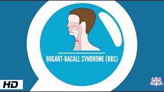 Bogart–Bacall syndrome Causes Signs and Symptoms Diagnosis and Treatment [upl. by Tegan]