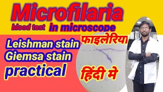 Microfilaria blood test hindi me II Leishman stain II Giemsa stain II microscope II microbiology [upl. by Torbart]