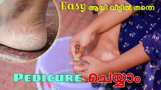 🦶🏻Easy ആയി Pedicure ചെയ്യാം വീട്ടിൽ തന്നെ10 min Pedicure at home EasilySimplyMyStyleUnni [upl. by Soane]