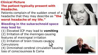 Subarachnoid Hemorrhage [upl. by Notslah]