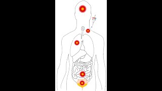 Empirical Antibiotic Use Overviewalgorithms for ESBL CRE MDR and XDR [upl. by Taryne790]