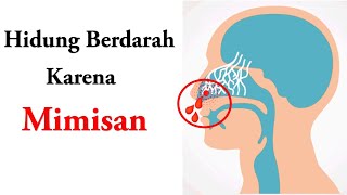 Hidung berdarah karena mimisan [upl. by Ahsinauq]