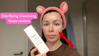 Shiseido Clarifying Cleansing foam review how my skin felt after [upl. by Fernandina293]