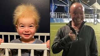 Uncombable Hair Syndrome and Other Rare Genetic Conditions [upl. by Garceau]