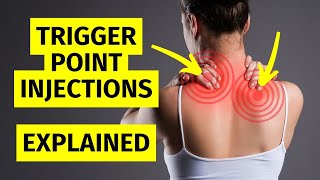 Myofascial Pain Trigger Point Injections Explained [upl. by Ydnec]