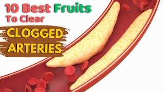 10 Best Fruits To Clear Clogged Arteries [upl. by Ventura579]