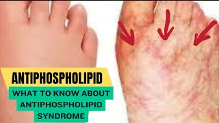 Antiphospholipid Syndrome [upl. by Joli]