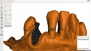 Advance Virtual Tooth Extraction [upl. by Aiciles]