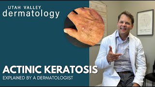 Actinic Keratosis Explained by a Dermatologist  Utah Valley Dermatology [upl. by Novelc758]