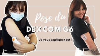 Aubépine  Je passe sous Dexcom G6 😱 [upl. by Nanette601]