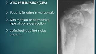 chondroblastoma case presentation with differential diagnosis [upl. by Garnes314]