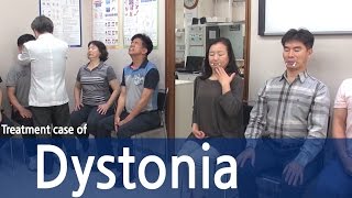 Dystonia Treatment of dystonia patients  사경증근긴장이상증 환자 치료 전후 비교 [upl. by Landan]