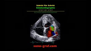 Echokardiographie  Schritt Für Schritt [upl. by Maillliw]