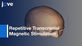 NeuronavigationGuided Repetitive Transcranial Magnetic Stimulation For Aphasia l Protocol Preview [upl. by Htebharas639]