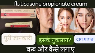 fluticasone propionate cream ip uses in hindi  daag dhabbe hatane ki cream bina side effect  face [upl. by Nnylecyoj]