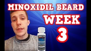 Monoxidil Beard  Week 3  Minoxidil 5 for Beard Growth  Facialfuzzfridays [upl. by Ddet]