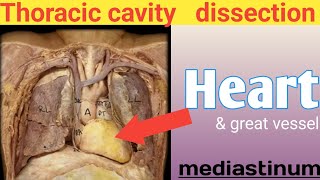 Heart dissection ❤ real human body Mediastinum thoracic cavity anatomy internal organs [upl. by Ysabel]